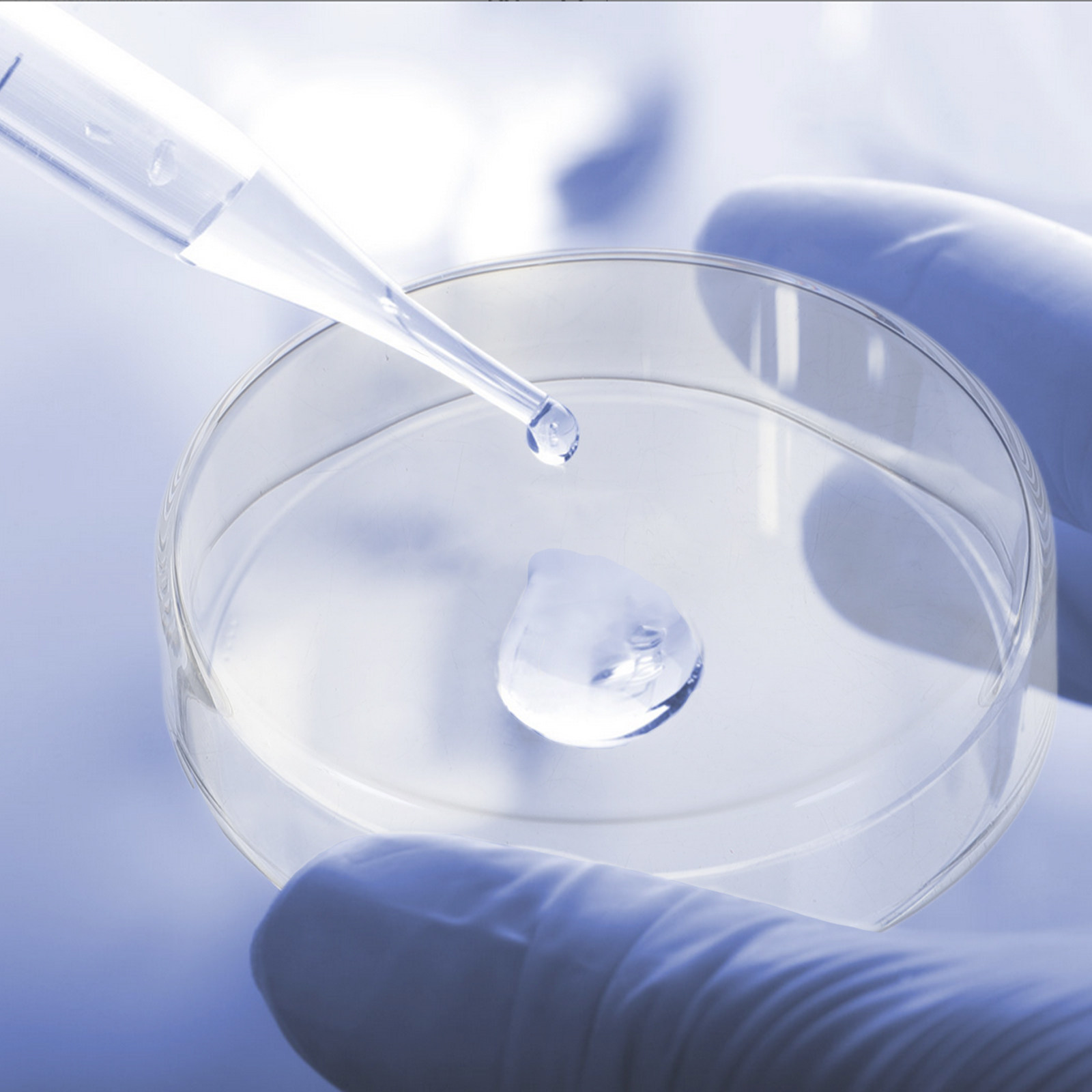1Set Verdikte Glazen Petrischa - Agar Tissue Culture recensie en prijs